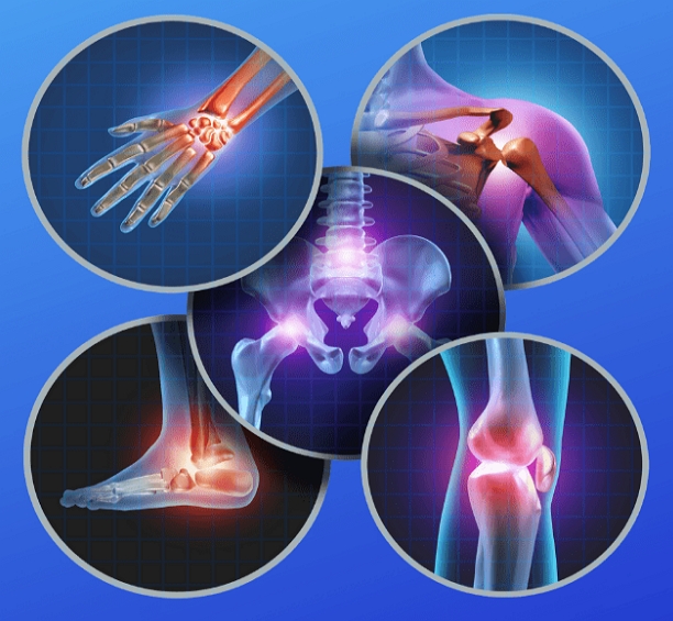 orthopedics